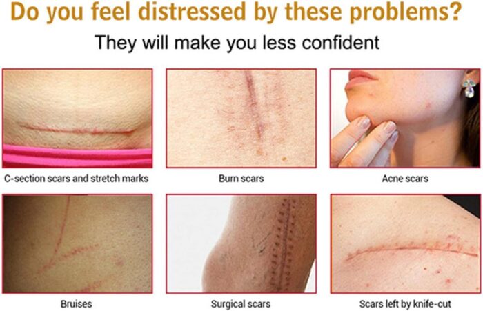 618KMEb3xuL. AC SL1500