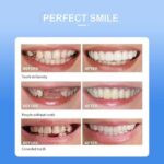 snap-on-smile-veneers-teeth-for-men-and-women-moldable-false-artificial-braces-teeth-4.jpg
