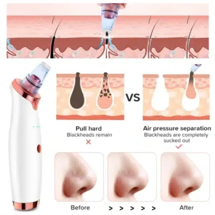 vacuum blackhead remover face black spots cleaner white dot pimple removal blackhead remover for nosefacial pore acne grease cleaner skin care 2 8